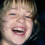 Laughing girl: Laughing girl with dental brace